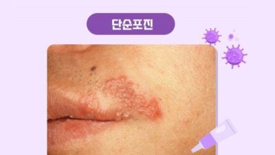 02월 07일 금일의 소식 HOT 5
