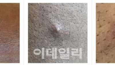 10월 22일  토픽 TOP 5
